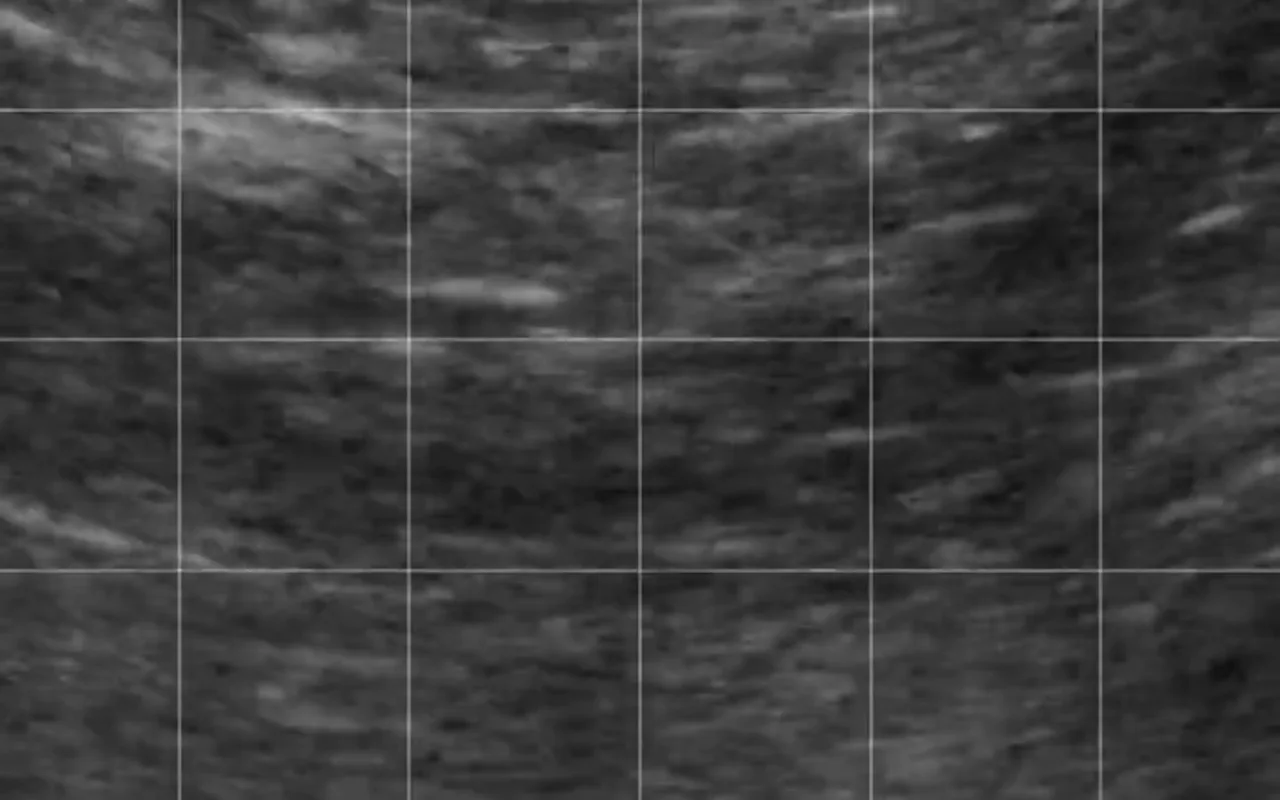 Ultrasound milk yield prediction